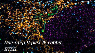 4 plex rabbit STED