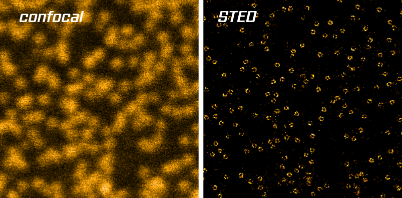 Fluorescence Image anti-GFP (NUPs)