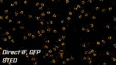 STED Nuclear Pore Complex GFP